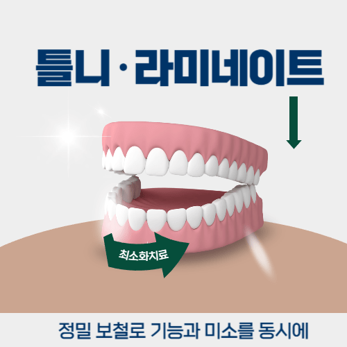 강남역라미네이트