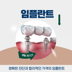강남역치과 임플란트