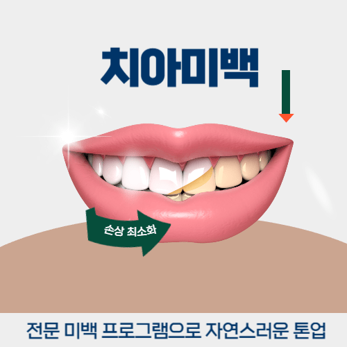 강남역치아미백