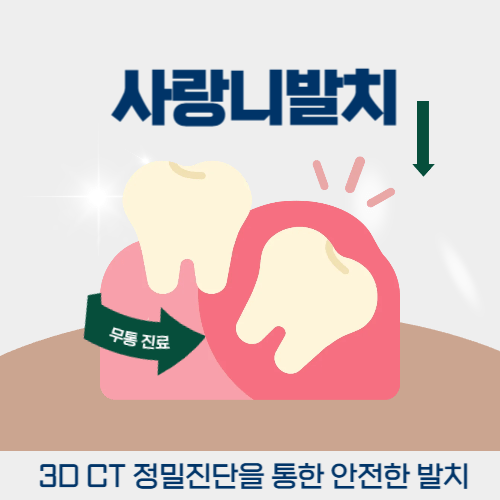 강남역사랑니발치